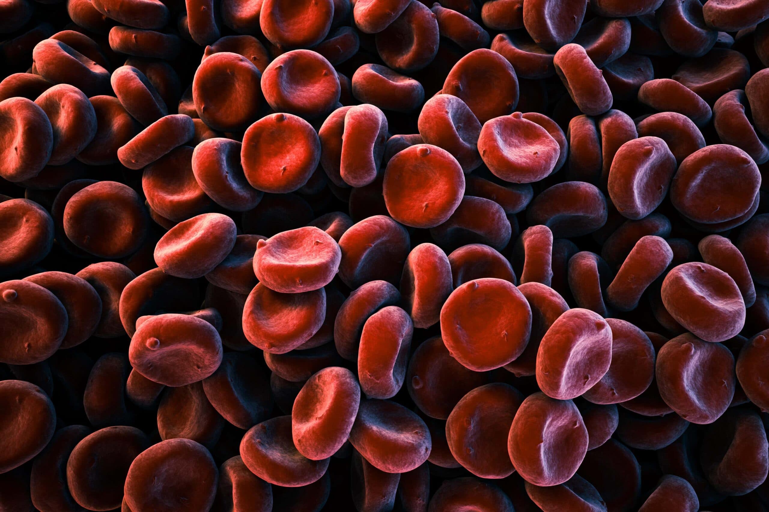 What causes blood clots